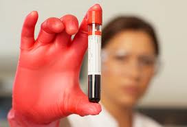 Diagnosed with Chronic Hepatitis B? What do the HBe Blood Tests Mean? - Hepatitis B Foundation