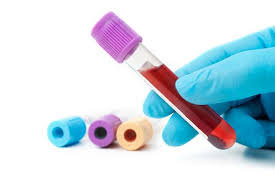 blood tubes
